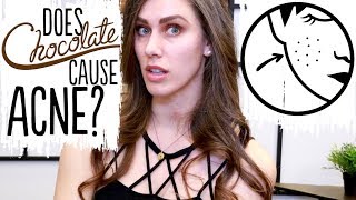 Does chocolate actually cause acne? the science on food, acne, diet,
sugar, cocoa, and acne your skin is in. i share my personal experience
as we brea...