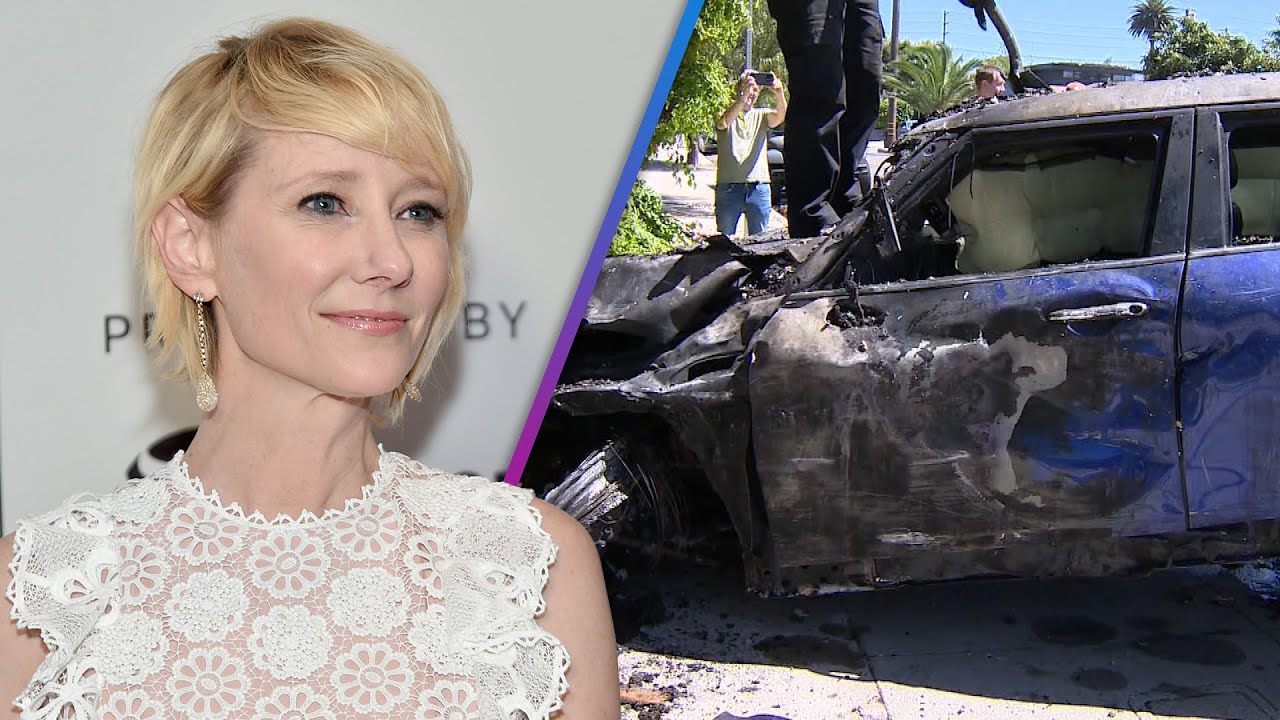 Anne Heche Car Crash: Doctor Explains Her Burn Injuries – Entertainment Tonight