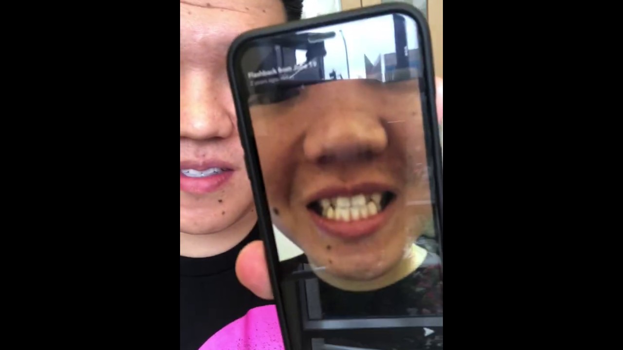 Smile Transformation by Dr. Sheila Mahooti