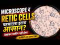 Microscope में Retic Cells पहचानना इतना आसान? देखकर यकीन नहीं होगा II retic count in microscope