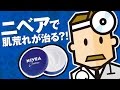 肌荒れ改善！ニベアクリームの気になる成分と正しい効果的な使い方【Dr.Ben*】