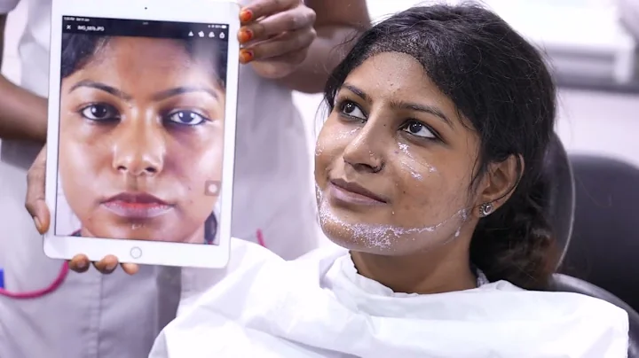 Face Change After Plastic Surgery in India | Facem...