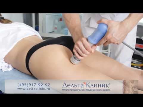 как убрать целлюлит? Целлюлит видео.