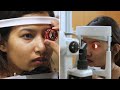 My ReLEx SMILE Eye Surgery Experience | Sonal Sagaraya