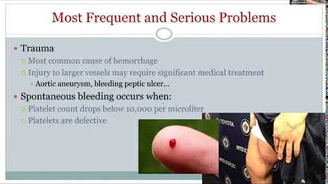 Pathophysiology- Bleeding & Clotting Issues (Ch. 10)