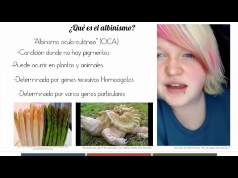 Vídeo: Albinismo: Causas, Tipos, Signos, Tratamiento, Complicaciones, Prevención