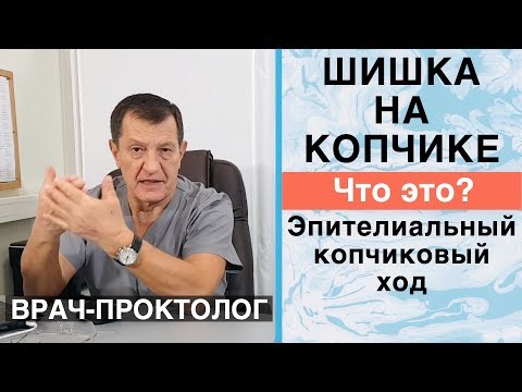 ШИШКА НА КОПЧИКЕ — Эпителиальный КОПЧИКОВЫЙ ХОД. Нужна ли Операция?