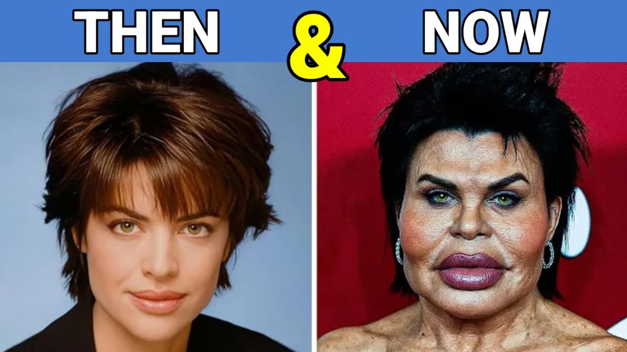 100 Celebrities Plastic Surgery Disaster Before and After YouTube