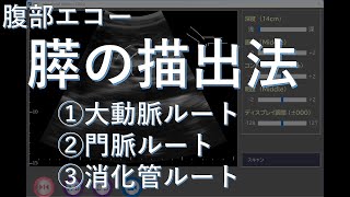 腹部エコー　膵の描出法３ルート　膵内胆管も出せる