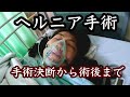 【壮絶】ヘルニア闘病記 避けてきた手術の決断 退院後の現在まで