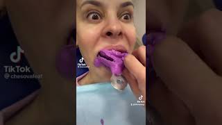 jaja cosas de dentistas #shorts #comedia #dentista #humor #odontologia