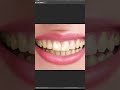 Day - 29 Easiest Way to Whiten Teeth in Photoshop!.