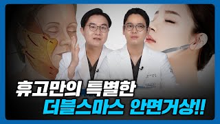 안면거상으로 팔자주름, 심부볼, 볼살 처짐 개선✨(feat. 두번 당기는 더블스마스)