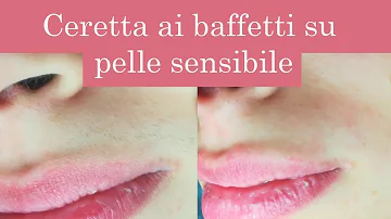 Come curare le bruciature da ceretta?