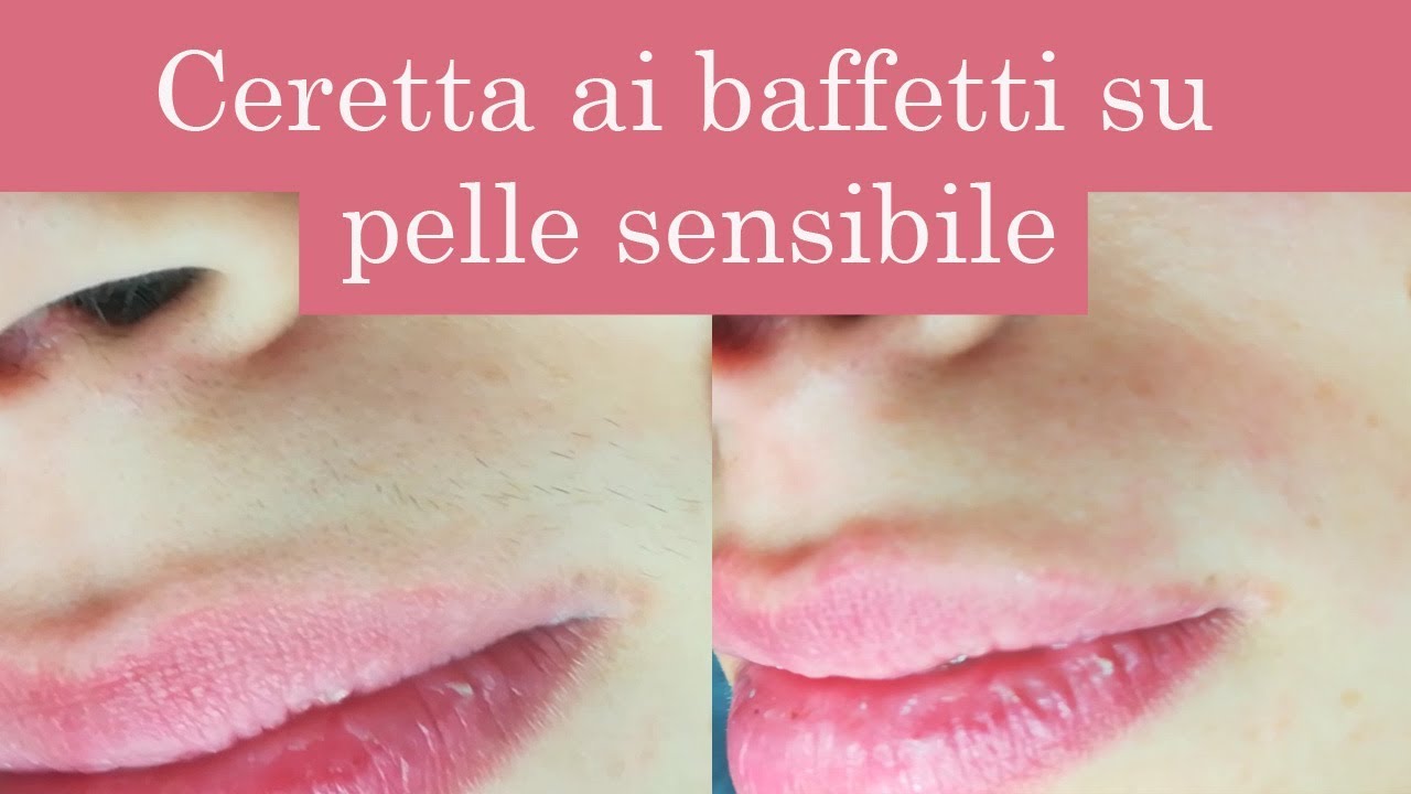 Estetica Tutorial: ceretta ai baffetti su pelle sensibile - come evitare  ustioni e macchie 