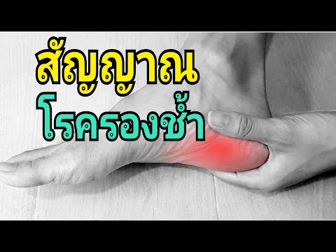 สัญญาณโรครองช้ำ