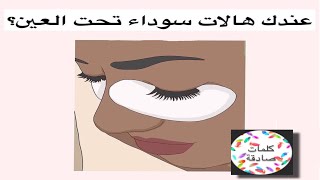 عندك هالات سوداء تحت العين ؟