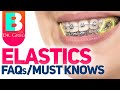 Braces Elastics / Rubber Bands – 5 Most Common Questions
