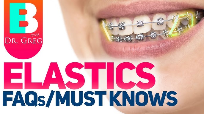 What Are Elastics For Braces?