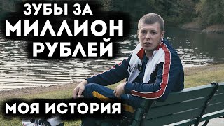 Зубы за МИЛЛИОН рублей. Моя история. Бюгельный протез против имплантов