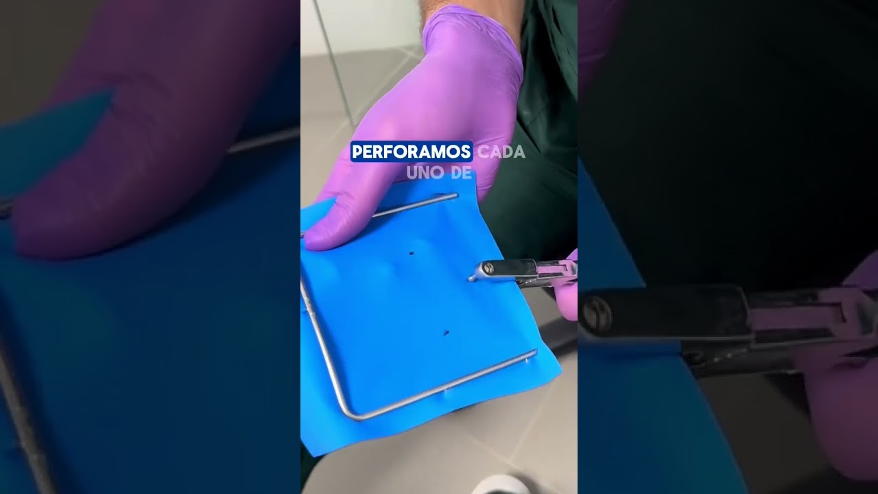 🦷🔵 Aislamiento dental con dique de goma absoluto modificado 💪✨