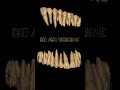 CAD/CAM #dentist #technology #dentistry #smile #shorts @dr.charu1