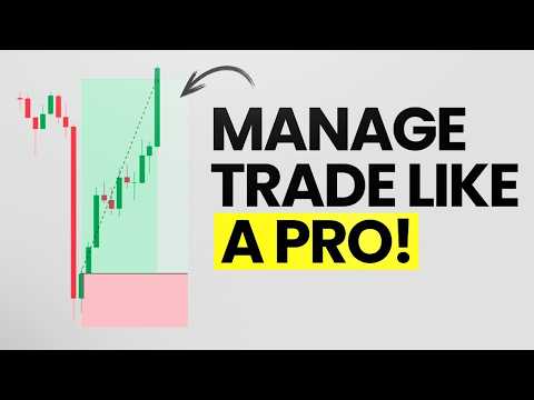 How to Manage