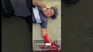Tagurreal friend 🥺💔#viral#sad #mela #shorts #shortvideo #explore #motihari