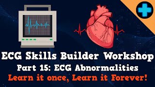 Electrocardiogram (ECG) Skills Builder Workshop Part 16: ECG Abnormalities Continued