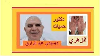 مرض الزهري والمرحلة الثانية