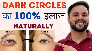 Dark Circles का 100% इलाज Naturally || आँखों के काले घेरे का Treatment