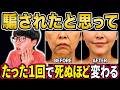 【1回でブルドック顔卒業💡】整形級に口元のたるみを引き上げる方法!目の下のたるみ、ほうれい線も解消!