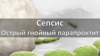 Сепсис. Острый гнойный парапроктит