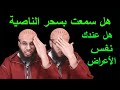 The Magic Of The Forehead Learn About It And Its Treatment God Willing Ruqyah Practitioner Ah 