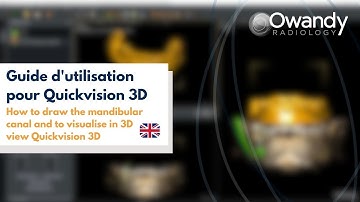 3/ How to draw the mandibular canal and to visualise in 3D view Quickvision 3D