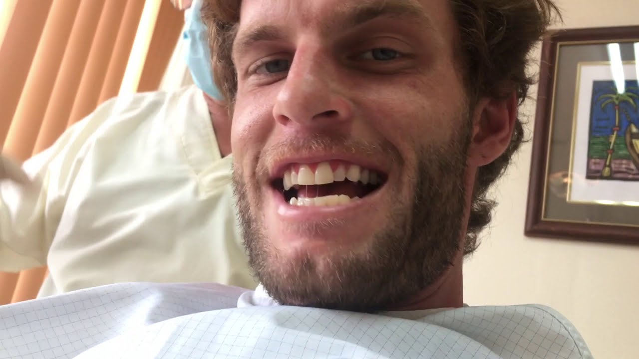 DENTAL WORK IN SAN JOSE COSTA RICA ROOT CANAL CROWNS DENTAL IMPLANTS