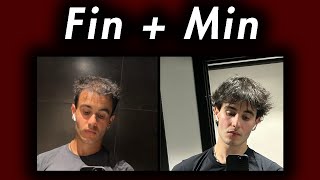 6 Month Hair Loss Recovery sas - mb Finasteride Oral Minoxidil
