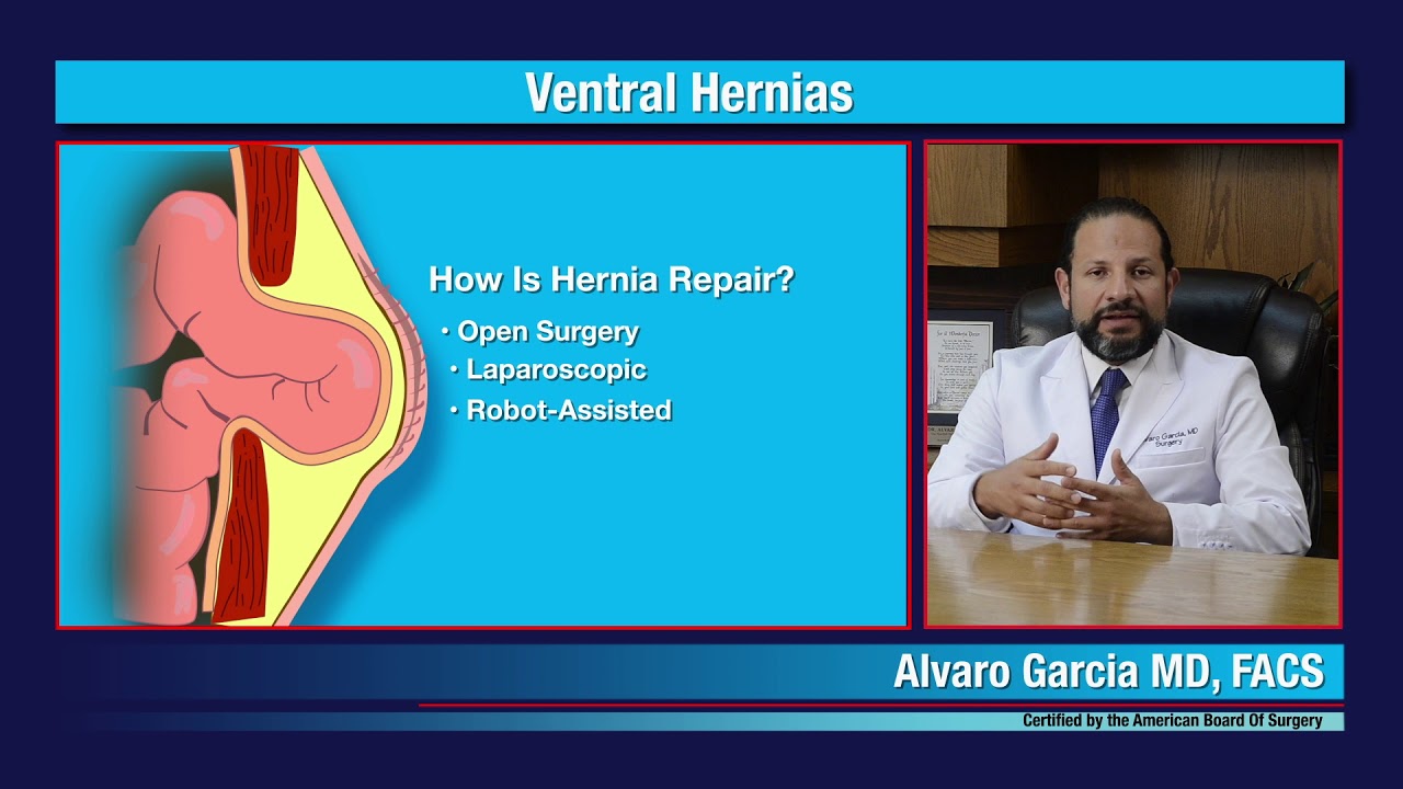 Robotic Ventral Hernia Repair, Alvaro Garcia MD YouTube