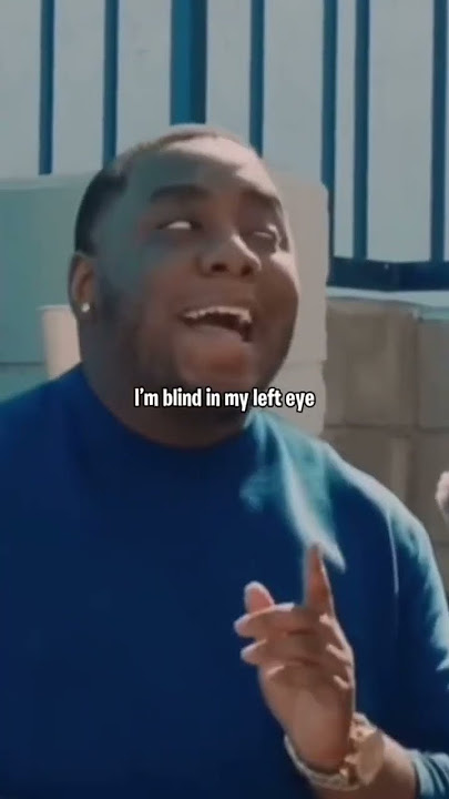 43% Blind In My Left Eye 😂 #shorts #tiktok #viral #funny #funnyvideo #viralvideo #funnymoments