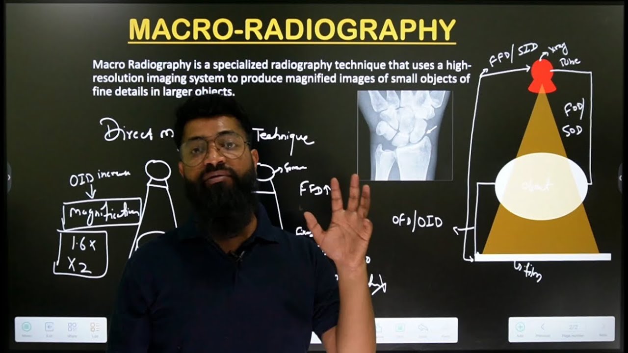 Macro Radiography || Magnification Radiography || In Hindi || Made Easy ...