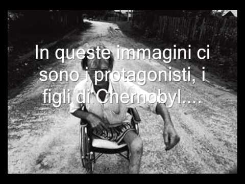 I FIGLI DI CHERNOBYL