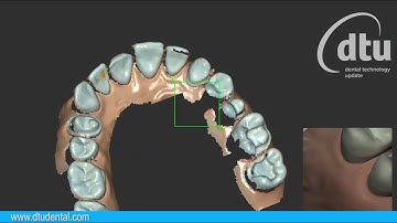 CS 3700 Scanflow 30s Scanning