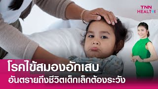 Live : เป็นไข้ คลื่นไส้ และอาเจียน อาจเสี่ยงโรคไข้สมองอักเสบ : TNN Health