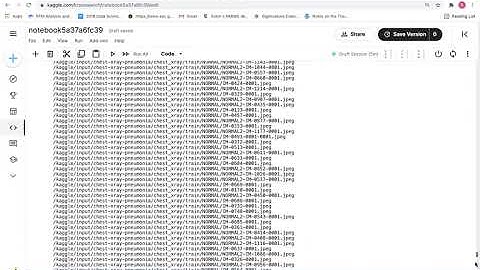 Covid X-ray Classification Convolution Neural Network Implementation Python Kaggle Notebook Part 1