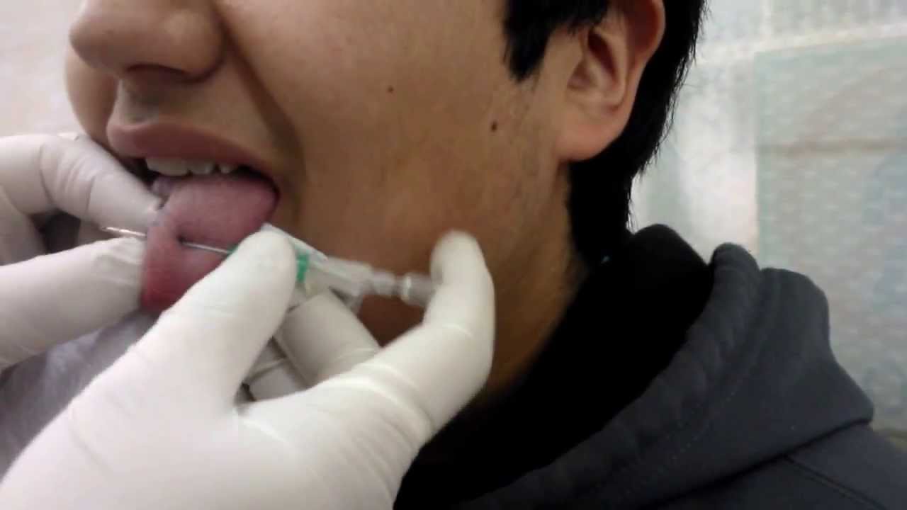 Piercing De La Lengua Banano Chile Youtube