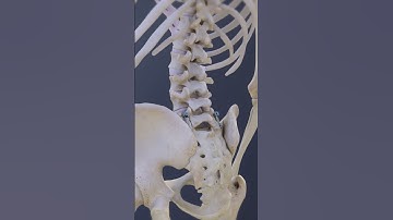 What is the Purpose of an L5-S1 Spinal Fusion?