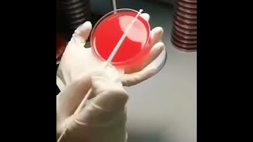 How do you Streak Bacteria on Agar Petri plate || Blood Agar || Culture of Bacterial colonies