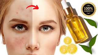 Vitamin C Serum: vitamin C toremove Dark Spots, Pigmentation, and Sun Tan provides Skin Whitening!