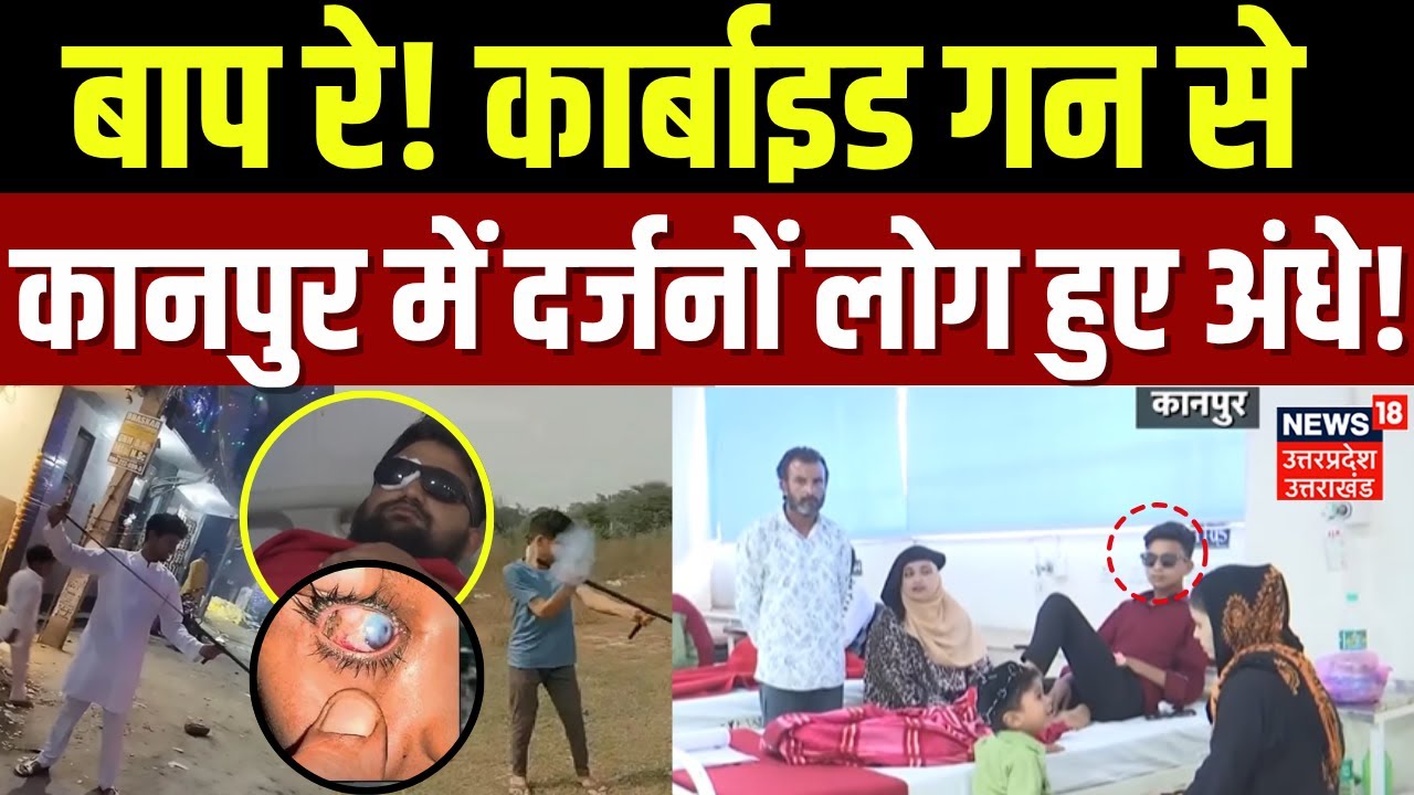 Carbide Gun News: आंखों को नुकसान पहुंचा रही कार्बाइड गन!, Kanpur में बच्चों की गई रौशनी | Diwali
