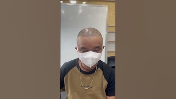 Cận cảnh thực tế xăm chân tóc cho người hói, trên đỉnh đầu đều là xăm